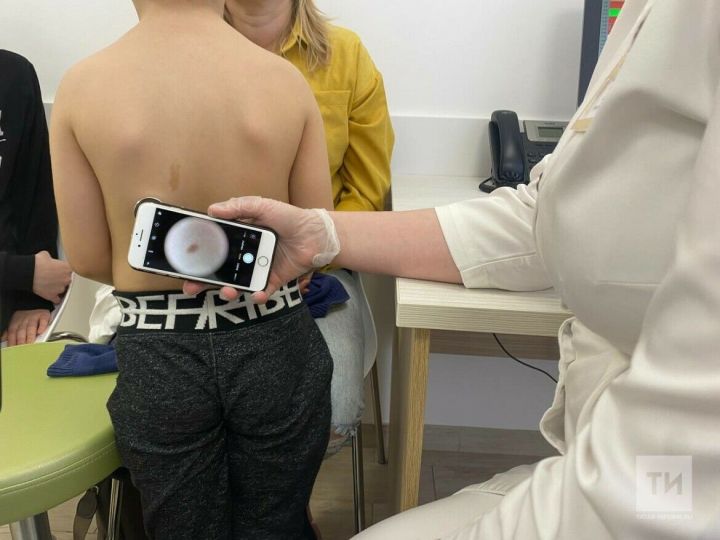 Как по числу родинок определить склонность к раку кожи