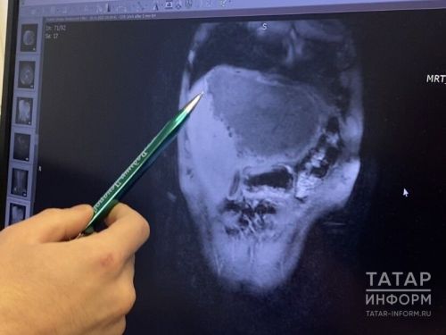 Терпеливый и молчаливый орган: как позаботиться о печени