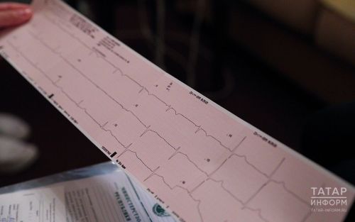 Врачи рассказали о том, как уберечься от инсульта и инфаркта