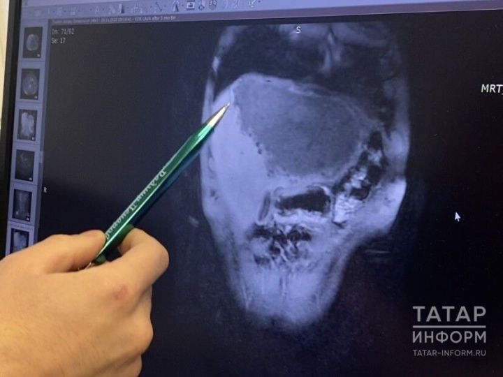 Терпеливый и молчаливый орган: как позаботиться о печени